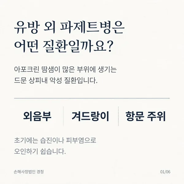 유방 외 파제트병은 어떤 질환일까: 아포크린 땀샘이 많은 외음부·겨드랑이·항문 주위에 생기는 드문 상피내 악성 질환, 초기에는 습진이나 피부염으로 오인하기 쉬움